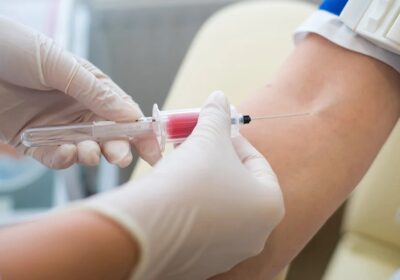 Interpreting the Complete Blood Count (CBC) Test Results