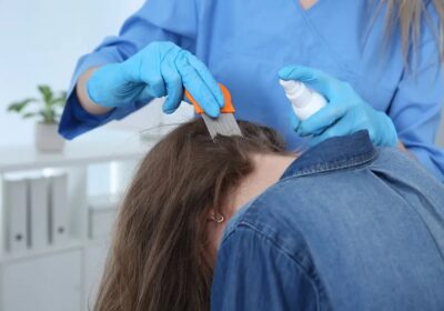 Steps to Lice Freedom: Removal Techniques in Philadelphia