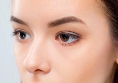 What Should You Know About Double Eyelid Surgery