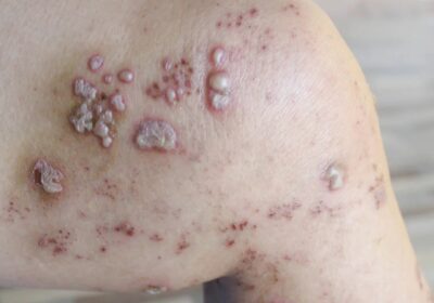 The Intricate World of Skin Issues: Understanding and Managing Common Problems