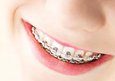 Cosmetic Dentistry: Enhancing Your Smile and Confidence