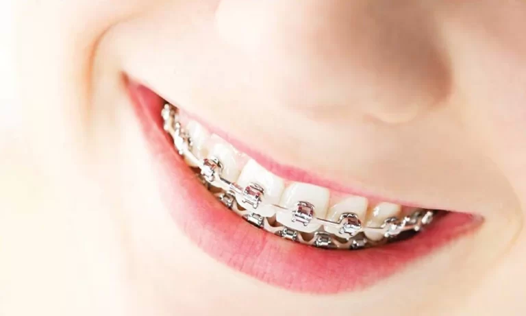 Cosmetic Dentistry: Enhancing Your Smile and Confidence