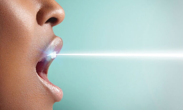 Laser Teeth Whitening