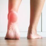 Revolutionizing Bunion Treatment: Exploring Non-Invasive Surgery Options for Foot Health